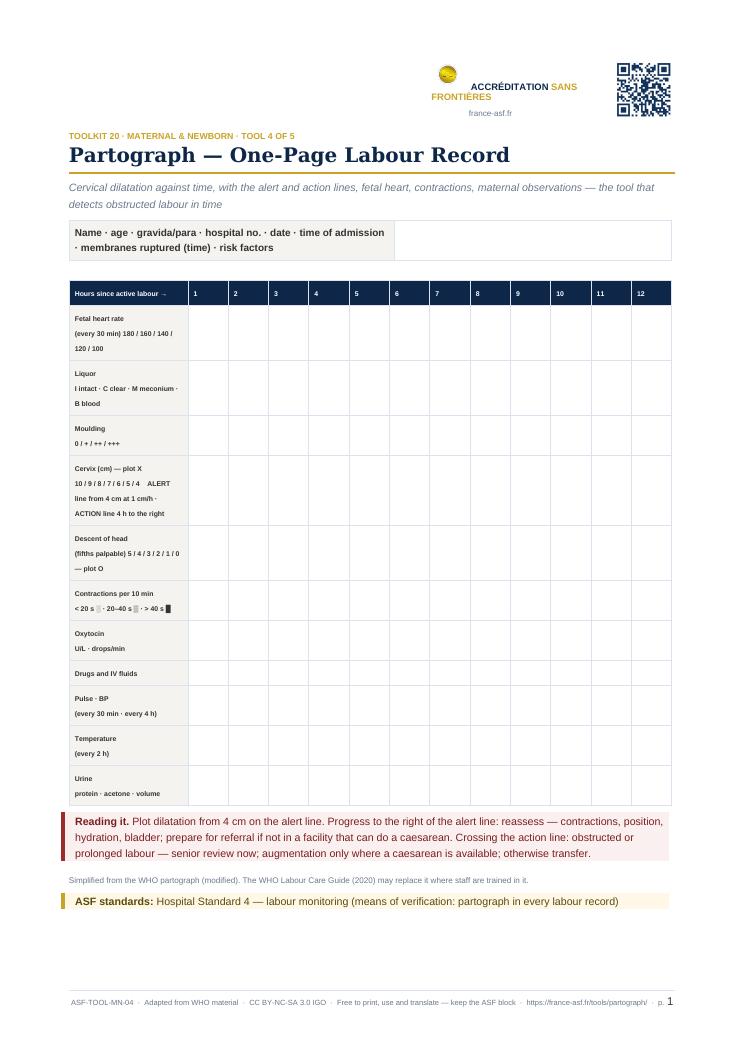 Partograph — One-Page Labour Record
